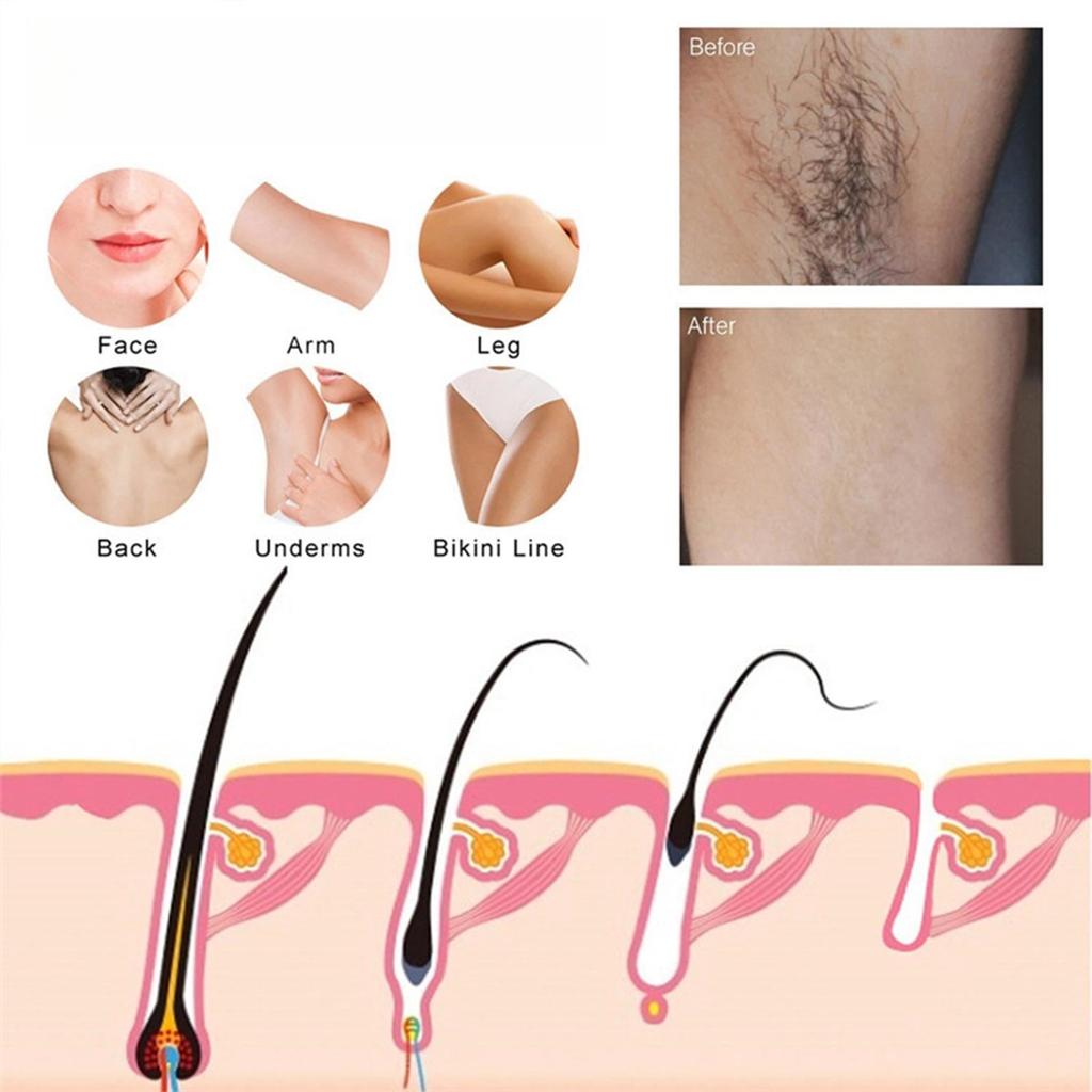 Спрей для удаления волос, спрей для удаления волос, бережное удаление волос подходит как для мужчин, так и для женщин, 220 мл