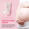 ATOPALM Maternity Care Stretch Mark Cream 150ml AUTHENTIC STORE