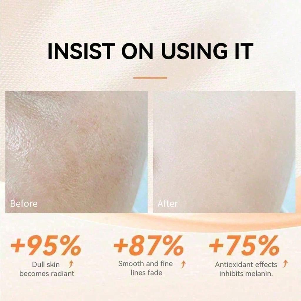 5X Vitamin C 20% Serum For Face With Hyaluronic & Amino Acids - Boost Skin Collagen,Hydrate & Plump Skin,Anti Aging,All Skin Types, 30 ML / 1.0 Fl Oz