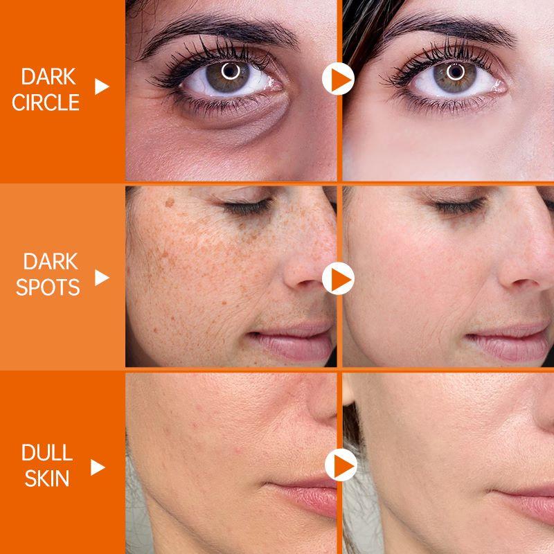 JoyPretty 15 мл антиоксидантная сыворотка для лица с витамином С, отбеливающая, осветляющая, увлажняющая, для лица, для удаления темных пятен, для красоты лица, для ухода за кожей с гиалуроновой кислотой