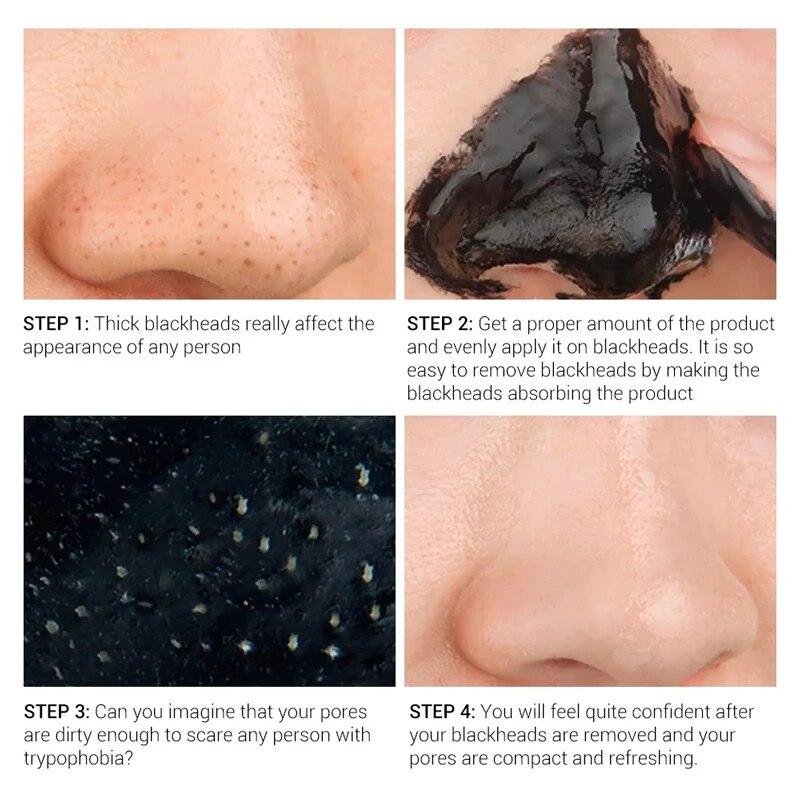 5/10 шт. в упаковке Маска для лица Beauty Nose Mask для удаления черных точек Black Point Pore Strip Peel Off Makeup Mask Black Points