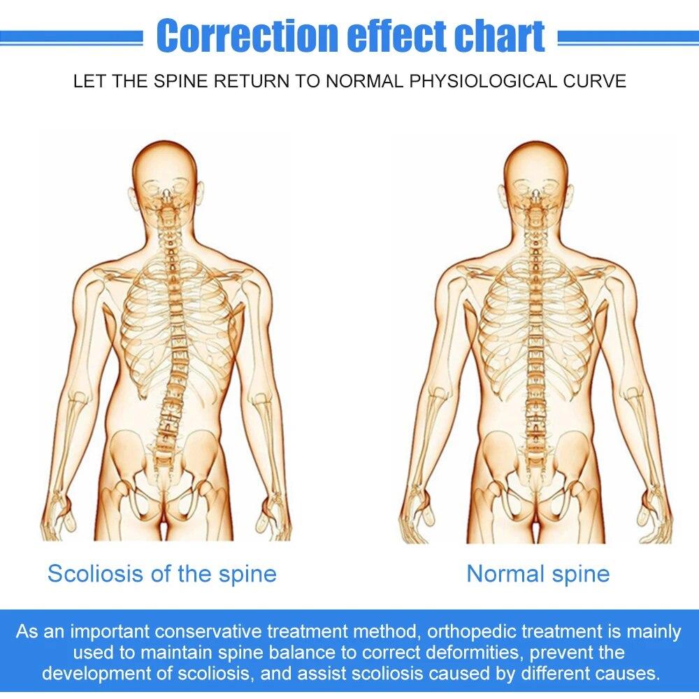 Tcare Регулируемый Корректор осанки при сколиозе Вспомогательный ортез позвоночника для послеоперационного восстановления спины унисекс для взрослых Здравоохранение