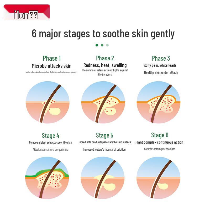 Ilon Classic Acne & Soothing Ointment