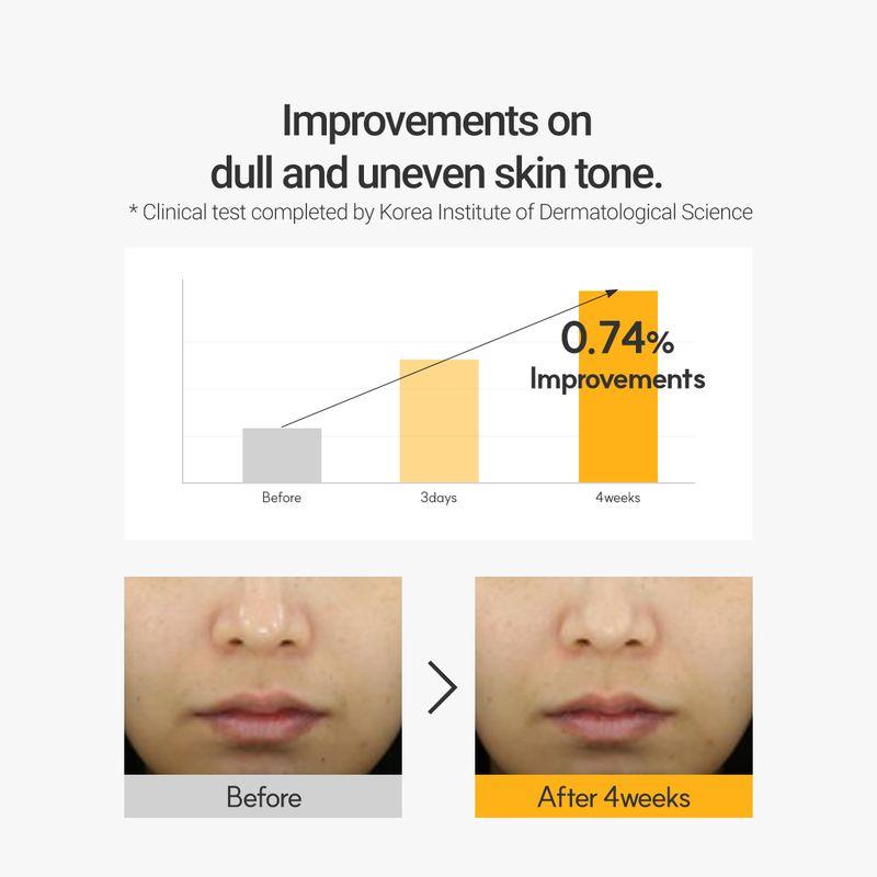 ROVECTIN Сыворотка от темных пятен Vita 30 мл