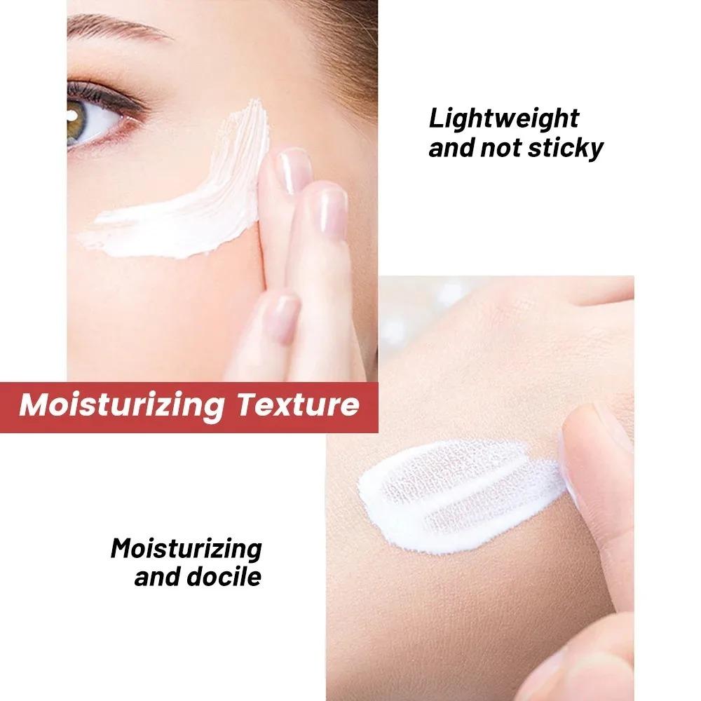 1/3/5pcs Whitening Freckle Cream Niacinamide Remove Dark Spot Cream Anti Freckle and Aging Cream Fade Pigmentation Melasma Skin