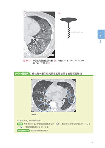 How To Write a CT Image Reading Report? - Basic Knowledge of Anatomy and Findings, and Examples of Reports for Common Diseases