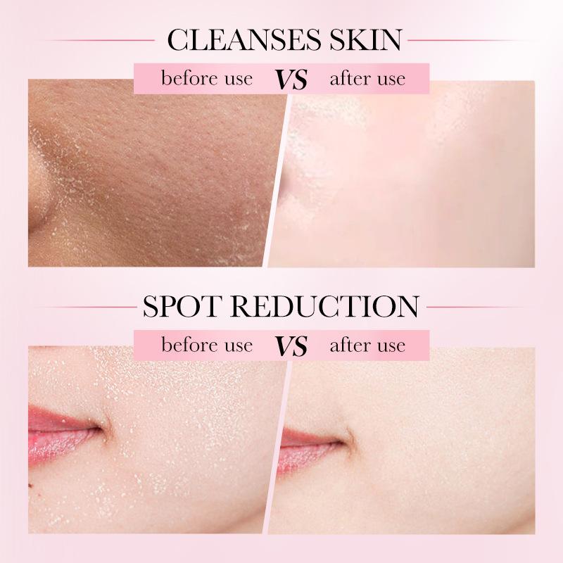 SAODER 4-в-1 Очищающий мусс для лица: Нежная пенка-мусс для увлажнения и осветления