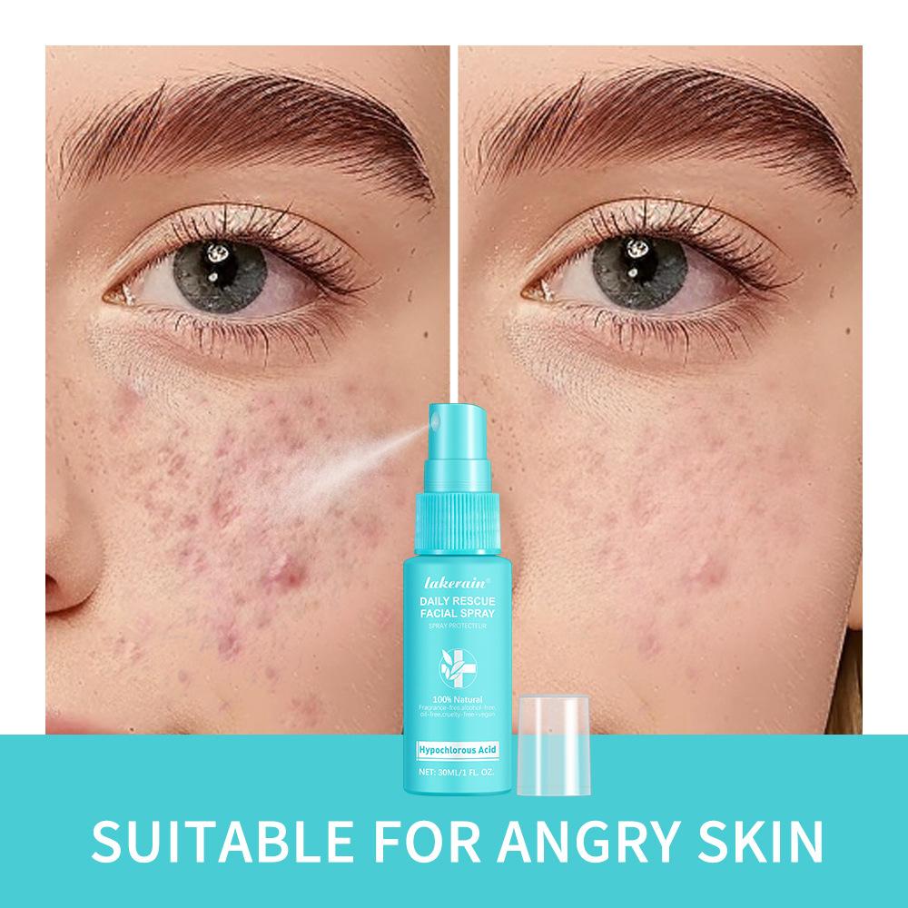 30 мл спрей для лица с хлорноватистой кислотой, увлажняющий успокаивающий увлажняющий тоник для лица