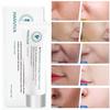 HANVIVA Removal Repair Skin Care Cream Крем для сужения пор Крем для ухода за кожей Увлажняющий Успокаивающий крем для кожи Улучшает огрубевшую кожу лица