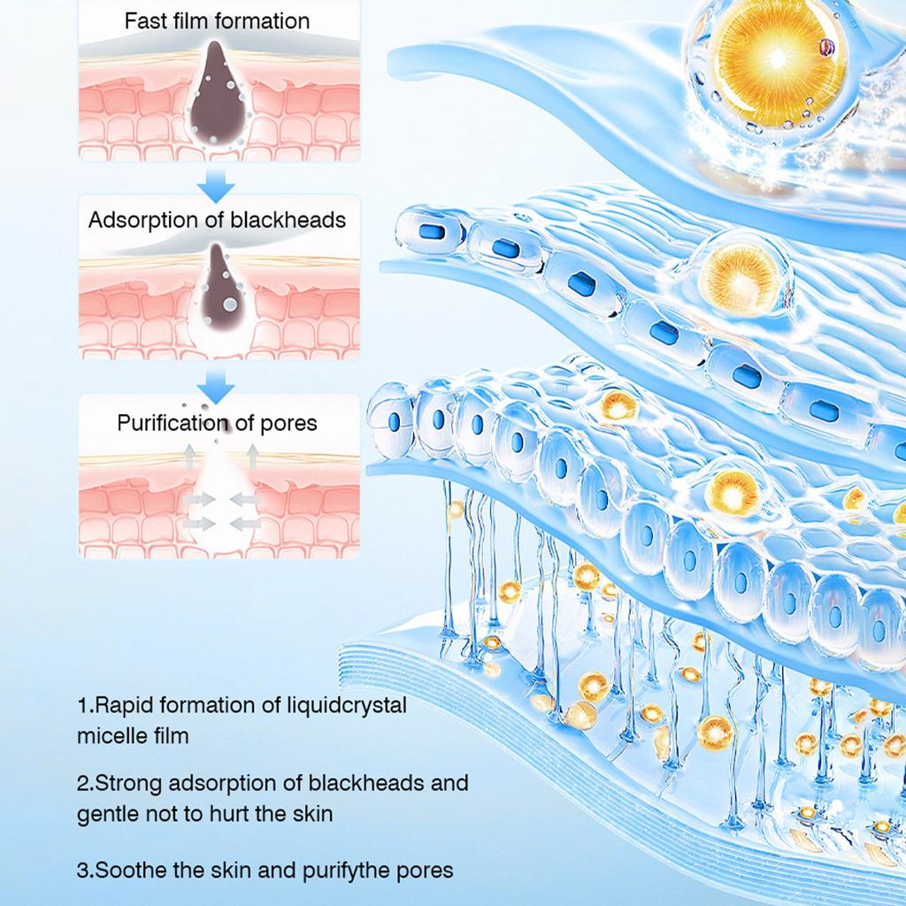 Remove Nasal Strips Pore Strip Clear Black Head 3-шаговый набор для чистки прыщей, сужения пор и удаления черных точек с помощью ложки +40 полосок 30 г