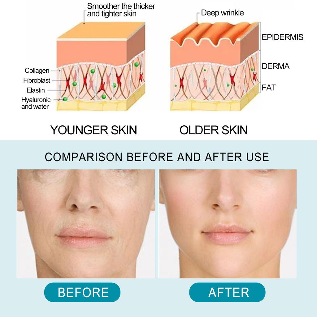 EELHOE 7 бутылок/набор, ампула с гиалуроновой кислотой, сыворотка для лица, сужающая поры, анти-никотинамид, отбеливающая, увлажняющая сыворотка против морщин