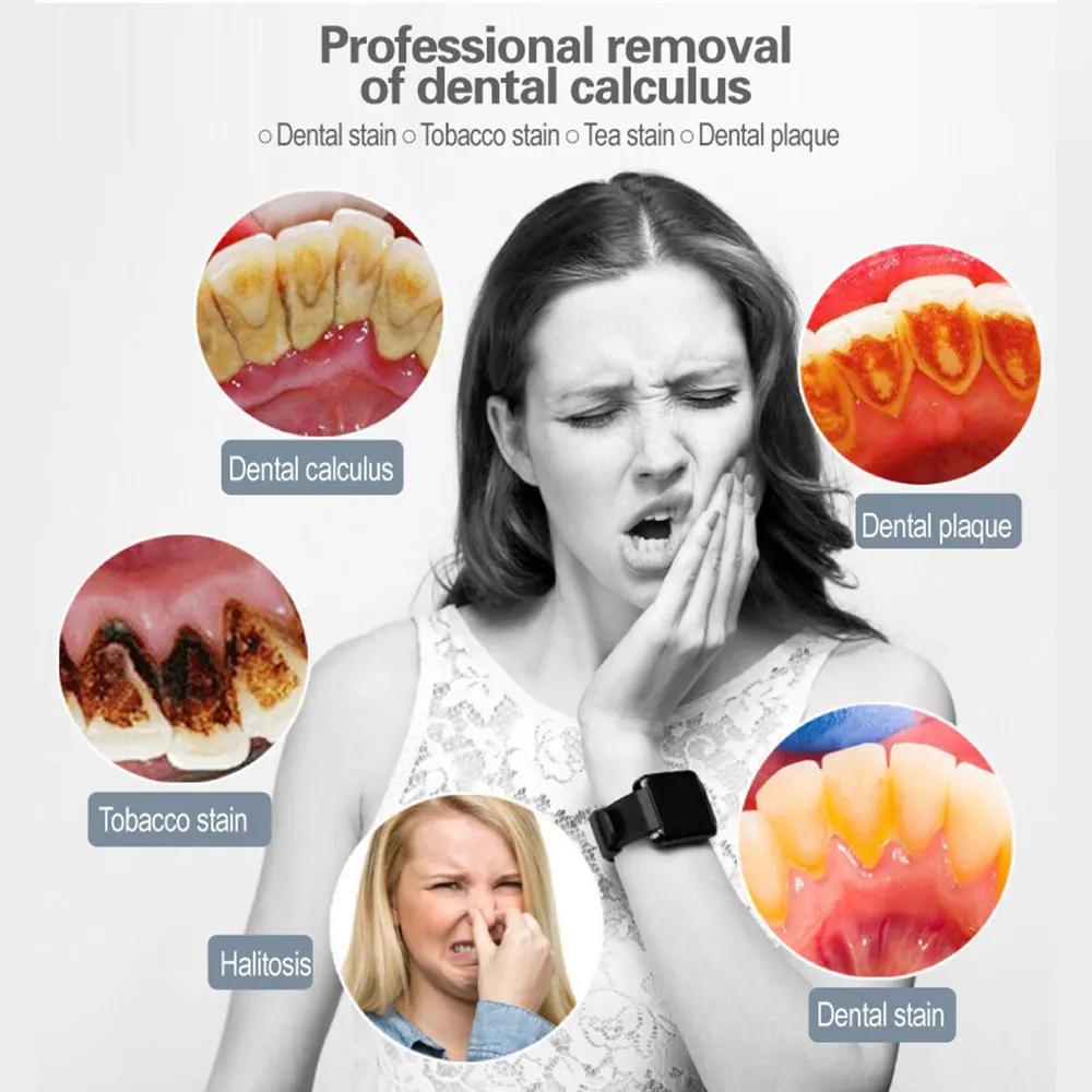Средство для удаления зубного камня, скалер, очиститель зубов, электрический очиститель для удаления зубного налета и пятен, отбеливание зубов, 3 головки, гигиена полости рта