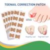 50 Pcs/Set Nail Ingrown Stickers Double-sided Adhesive Ingrown Toenail Correction Ingrown Toenail Correction Tool Elastic Patch Stickers