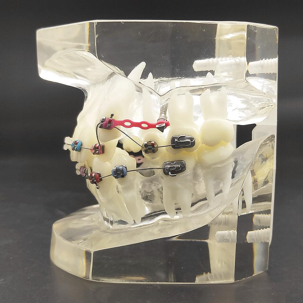 1 шт., прозрачная стоматологическая ортодонтическая модель прикуса с брекетами, буккальная трубка дуги для общения с пациентом