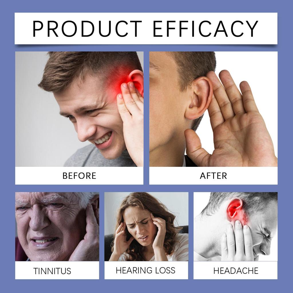 South Moon Шум в ушах Назальный стик Мягкий уход за ушами Снимает дискомфорт при шуме в ушах Удобный назальный стик для здоровья ушей