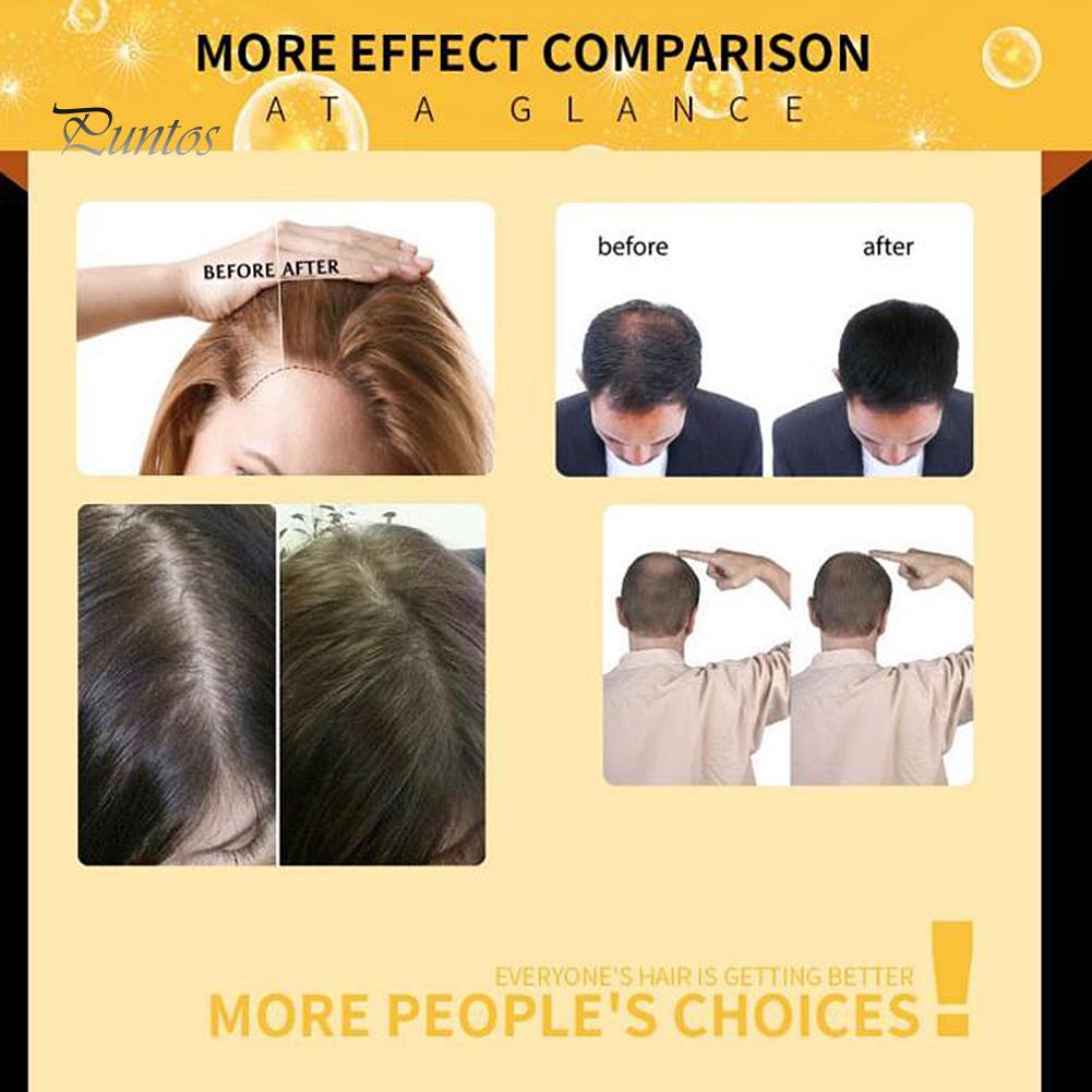 Puntos LAVDIK 20 мл Сыворотка для роста волос Эфирное масло Ремонт поврежденной питательной жидкости