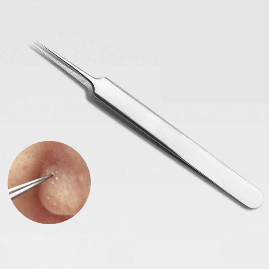 Stainless Steel Acne Extractor Tool for Blackheads and Pimples