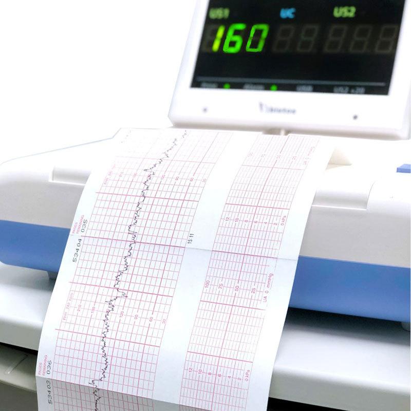 Ecg Ekg Machine 50Mm*20M/80Mm*20/110Mm*20M /210Mm*20M Electrocardiograph Thermal Printer Paper
