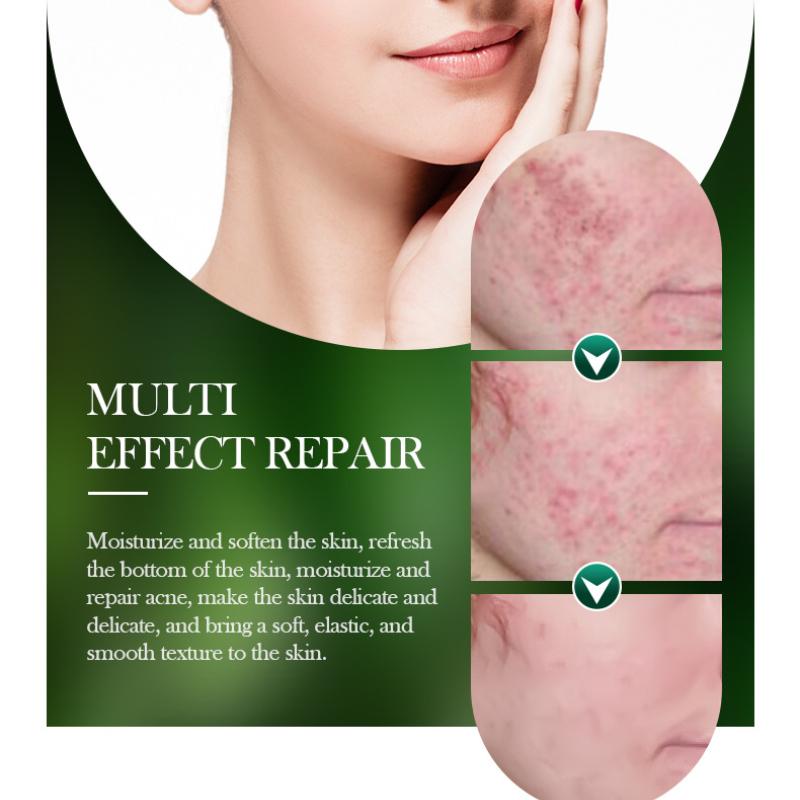 Tea Tree Mask 25g SADOER Refreshing Moisturizing Moisturizing Tablets