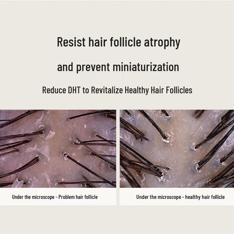 Шампунь Hathaway Ginger для роста волос с имбирем