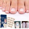 Toenail Pedicure Tools Physical Straightening Corrector Elastic Correction Correction Patch Patch Sticker Clip