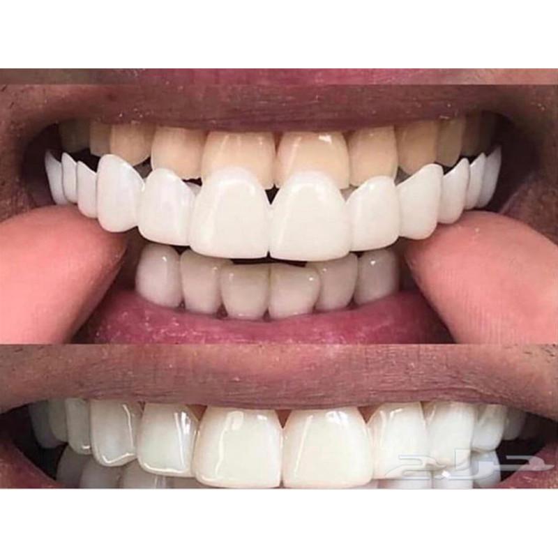 Стоматологический Snap Smile Стоматологические Верхние Накладные Зубы Cover Идеальная Улыбка Виниры Удобная Посадка Отбеливание Зубной Протез Брекеты Оборудование 2030