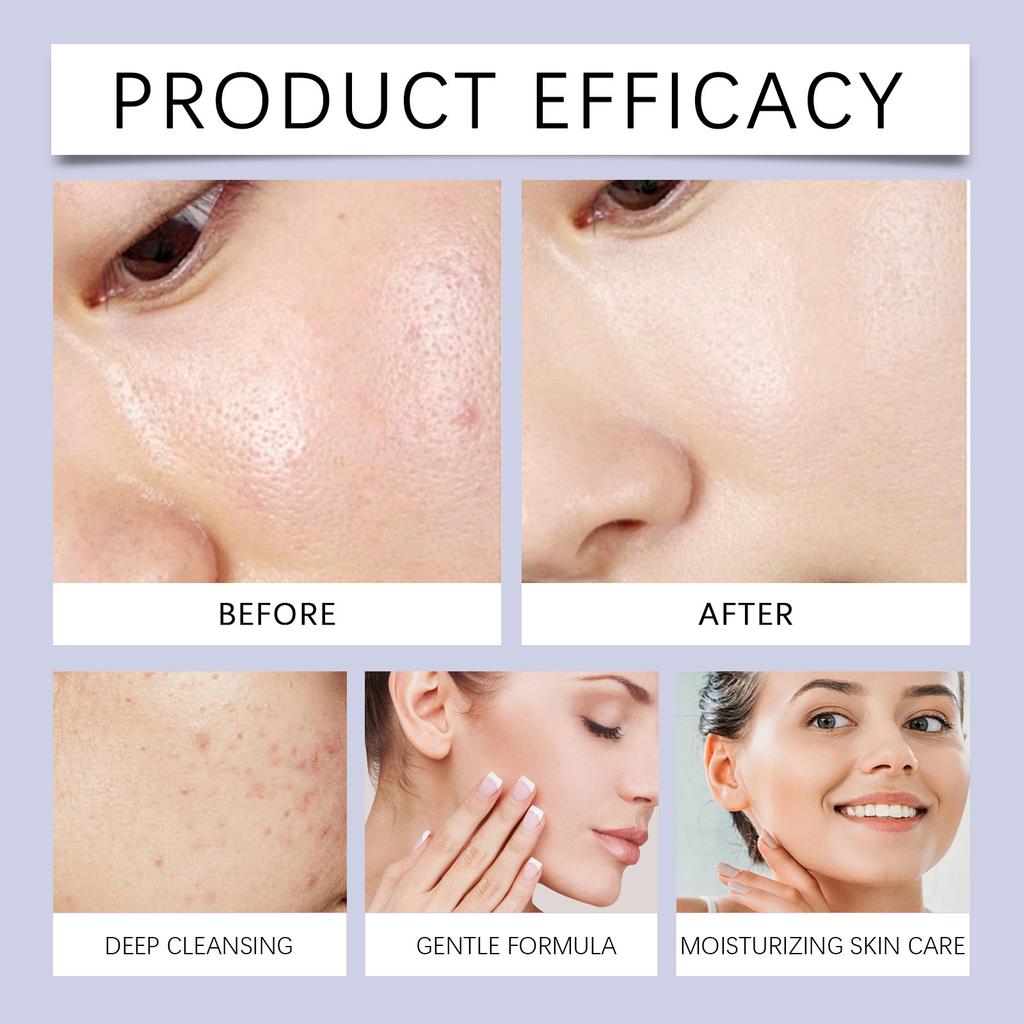 Нежное и успокаивающее очищающее молочко. Мягко очищает поры. Устраняет угри. Очищает. Освежает. Сужает поры. Увлажняет. Увлажняет.