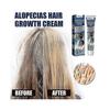 1-3X New Alopecia Treatment Cream Hair Growing Prevent Alopecia Baldness Regrowth 20g