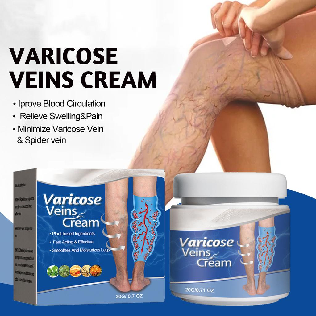 Varicose and Spider Veins Ease for Legs, Improve Blood Circulatio