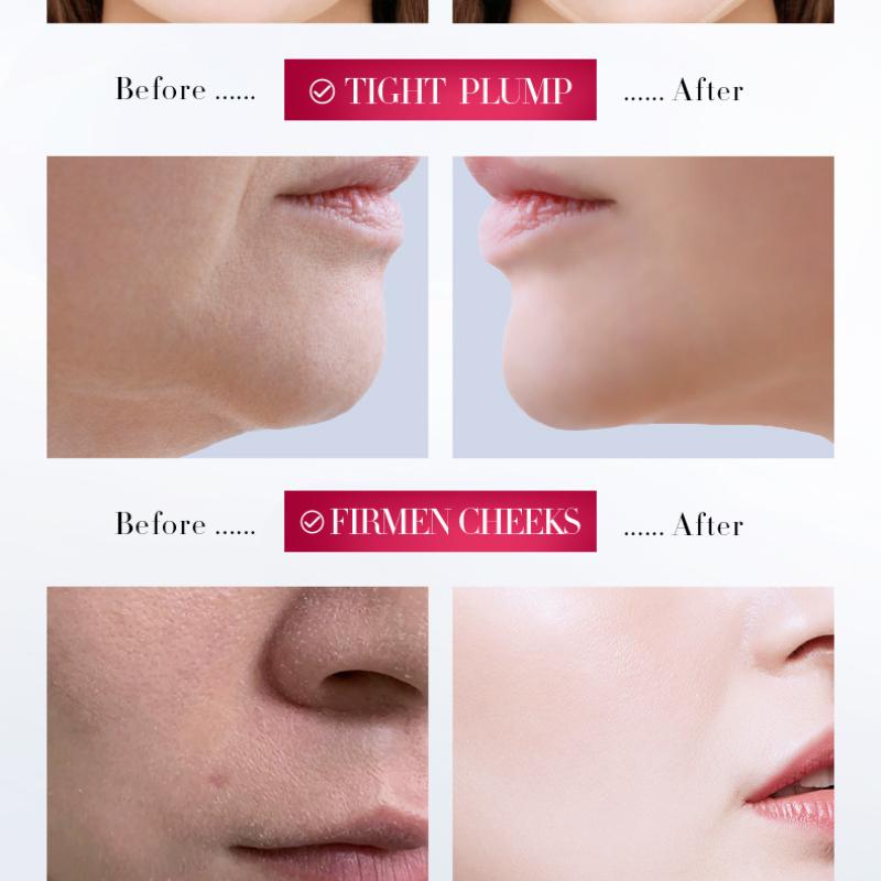 V Face Firming Cream 30 гSADOER Facial Lift Firming Skin Facial Cream