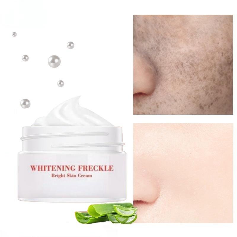 Яркий крем для кожи Мощный отбеливающий крем от веснушек Удаление мелазмы Акне Пятна Пигмент Меланин Темные пятна Крем для ухода за лицом