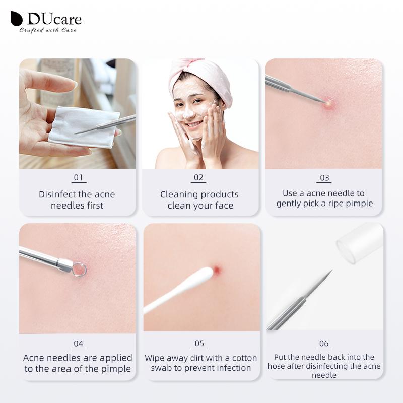 Набор косметологических инструментов для удаления угрей 4шт
