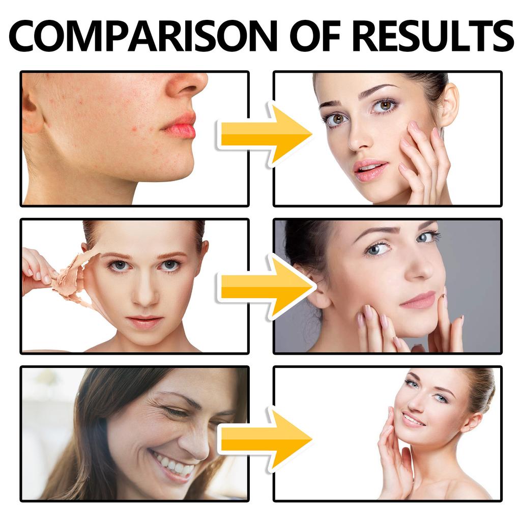 EELHOE Сыворотка для лица с гиалуроновой кислотой, увлажняющая, отбеливающая, укрепляющая, выцветает, тонкие линии, против морщин, против старения, эссенция для глубокого ухода, 40 мл