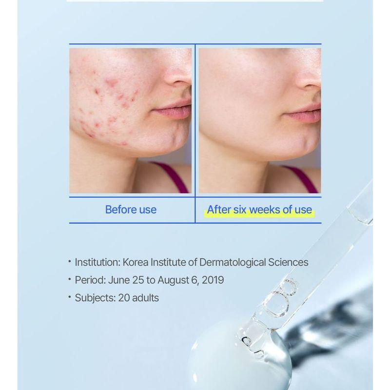 The Face Shop Доктор. Бельмеур Очищающая ампула для точечного ухода
