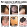 Hair care essence,East Moon Men's Hair Essence Nutrition Moisturizing Hair Care Solution - 30Ml