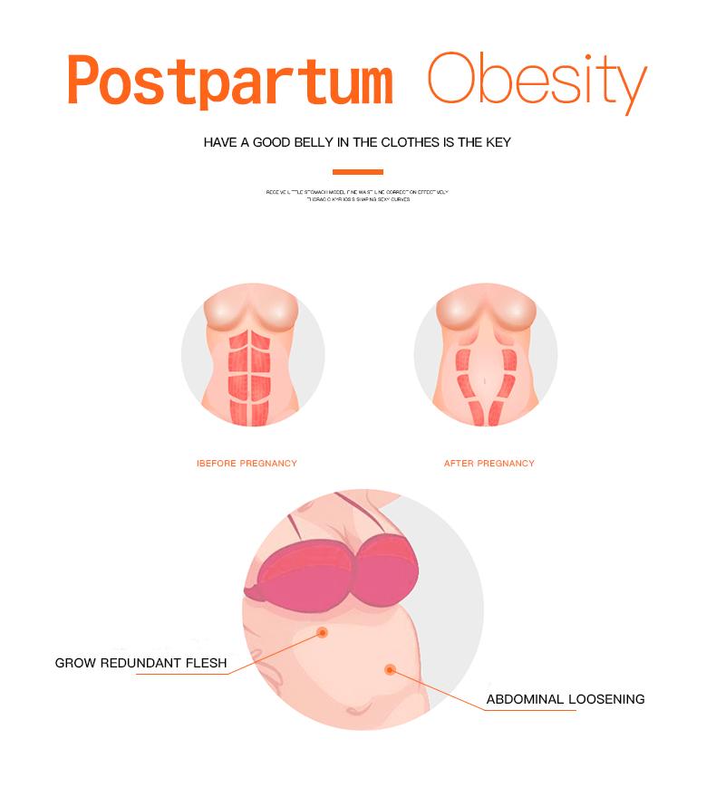 Корректирующее белье Корсет для талии с верхней поддержкой и сборками Корректирующее белье для женщин Корсет для талии после родов Корсет для живота