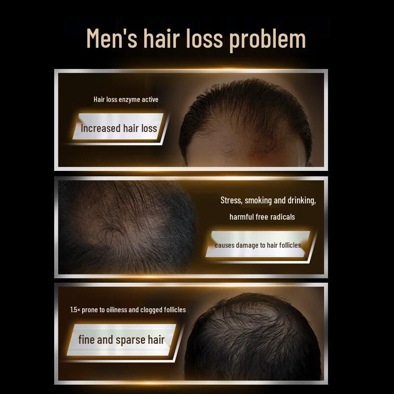 CLEAR Men's Anti-Hair Loss & Anti-Dandruff Shampoo