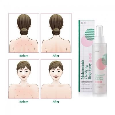 Koelf Madecassoside Clarifying Body Spray 150ml AUTHENTIC STORE