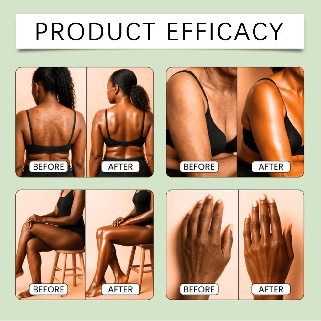 Увлажняющий и осветляющий крем для тела подходит для ежедневного ухода за интимными зонами, подмышками, коленями и локтями.