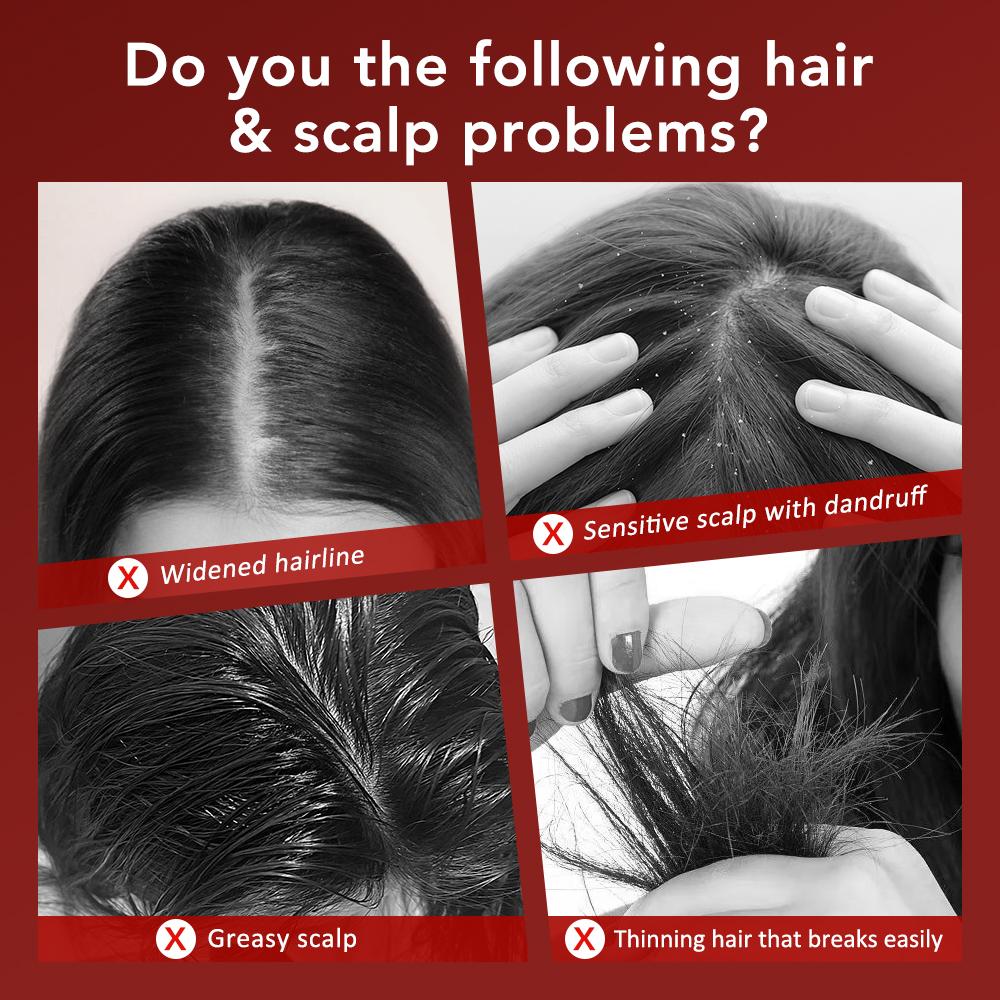 Electric Massage Comb Vibration Hair Massage Scalp Brush Red Light Hair Growth Massager Liquid Oil Applicator Anti Hair Loss