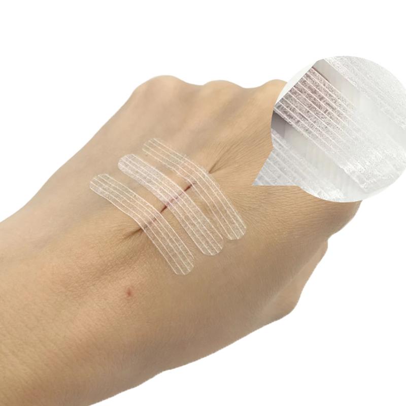 Полоски для закрытия ран Хирургические швы Послеродовое лечение ран Косметическая хирургия Клей Медицинское здравоохранение