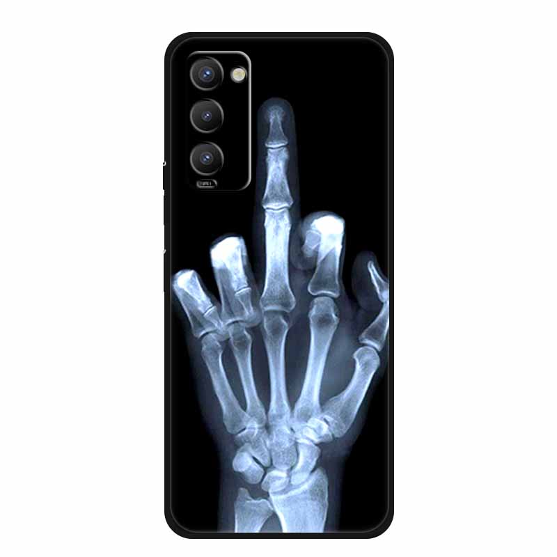 Чехол для Tecno Camon 18 Мультяшный Мягкий Силиконовый Задняя Крышка Funda для Tecno Camon 18P Camon 18T 18 P Coque ТПУ Животное Camon18 Чехлы