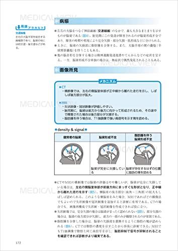 Learning from the Mechanisms of the Human Body: Diagnostic Imaging Technology