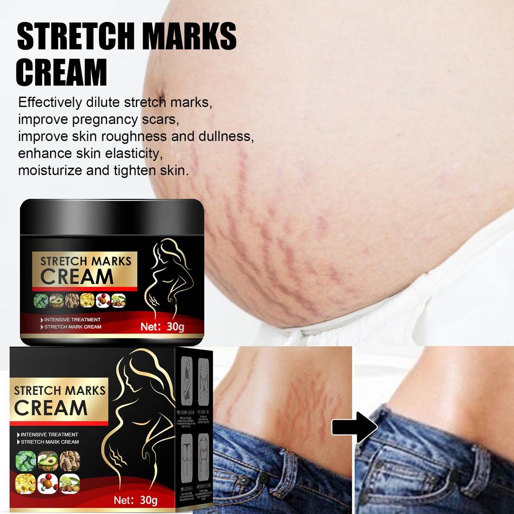 Органический бальзам для кожи и шрамов. Восстановление ран и кесарева сечения. Уход за кожей, шрамы от растяжек при беременности.