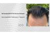M-Shaped Men's Clip-In Hairpiece: Real Hair Bangs for Volume, Natural Hairline Enhancement, Fluffy, Invisible Attachment.