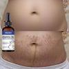 Abdominal Massage Oil for Removing Stretch Marks, Moisturizing and Hydrating Massage Oil