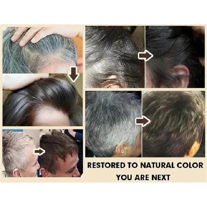 White To Black Gray White Hair Serum Natural Color Repair Nourishessence Anti-gray Care For Men Women *5&JI^