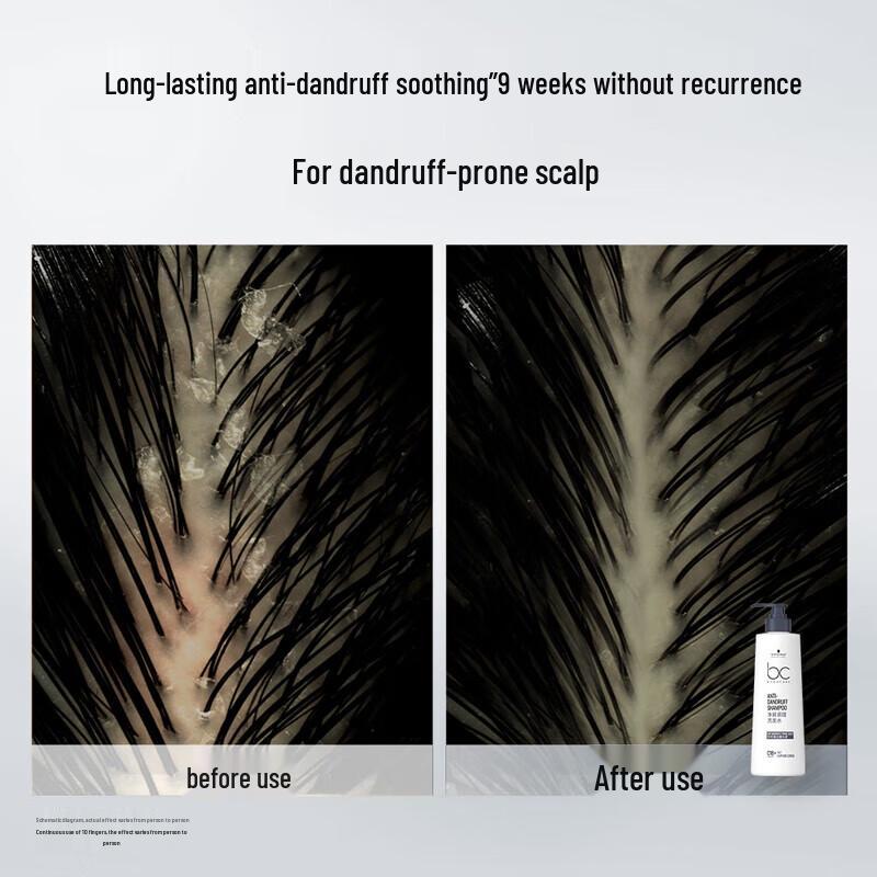Шампунь против перхоти Schwarzkopf Professional 500г