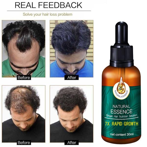 Hair Growth Essence, Hair Care Products, Hair Essence, Fast Hair Growth, Nourishing Hair, Moisturizing And Softening Hair Quality