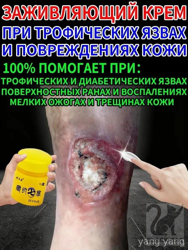 Мазь для спины при болях в пояснице, грыже поясничного отдела, Крем для спины **** shts от боли, 50 г